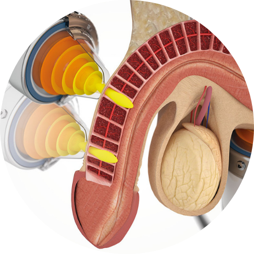 disfunctie erectila Divi events section